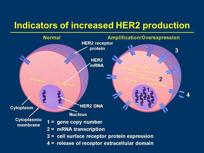 Know The Status of Her2 Cancer With Focus Survival Rates ...