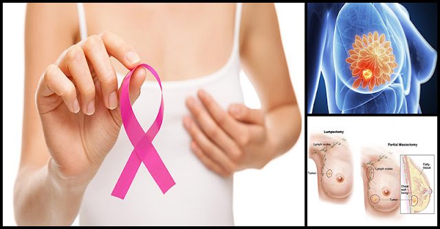 Reasons Why Many Women Experience Breast Cancer ...